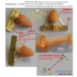 1/350 WWII IJN Medium Size Paravane for Small Vessels (Destroyers and smaller vessels) (8set)
